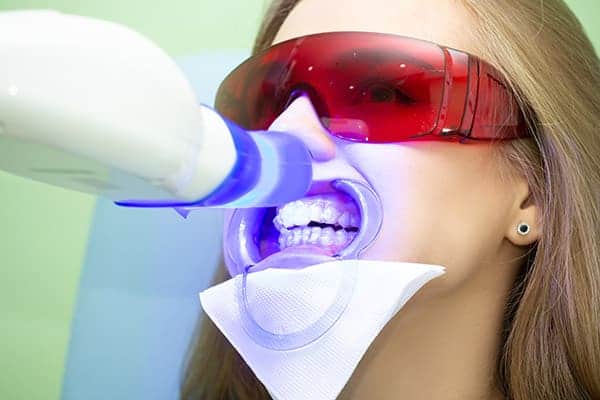 Laser teeth whitening treatments St Neots