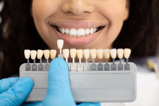 Laser Teeth Whitening: Exploring the Longevity of Your Brighter Smile St Neots