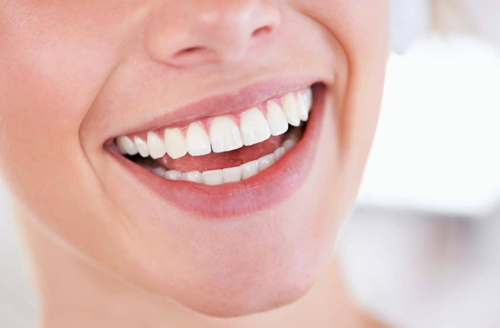 Teeth Whitening West Drayton St Neots