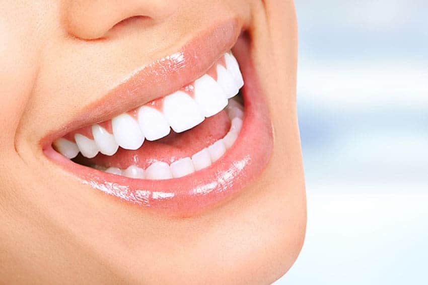 Teeth Whitening Abingdon St Neots