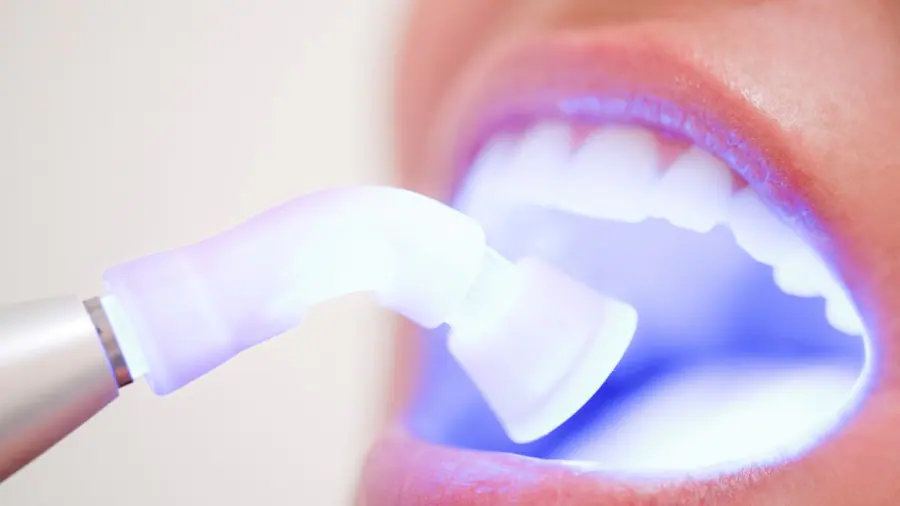 Teeth Whitening Aylesbury St Neots